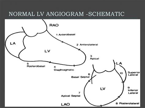 left ventricular gram.